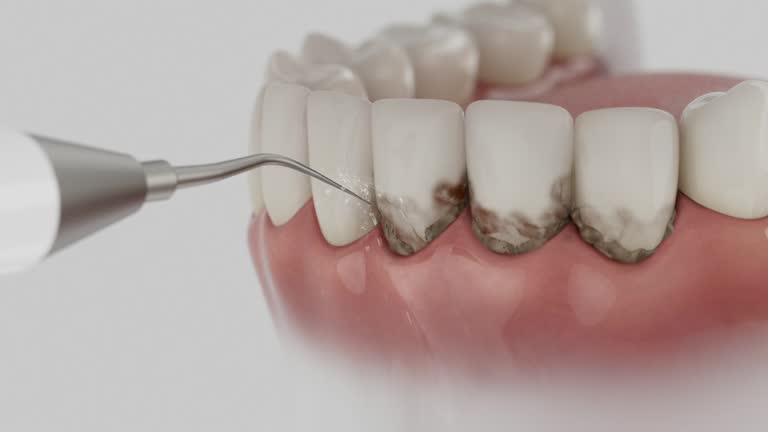 Reliable Dental contractor in Chain Lake, WA by Dentist Open Now